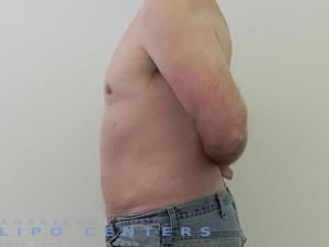 americanlipocenters_4.jpg